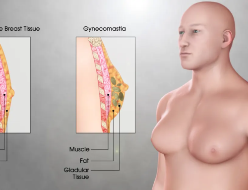 Remodelage de la silhouette pour hommes : les interventions les plus demandées