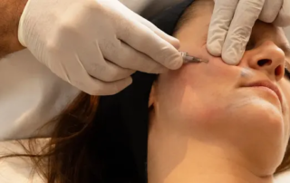 il est temps de réaliser vos injections de Botox