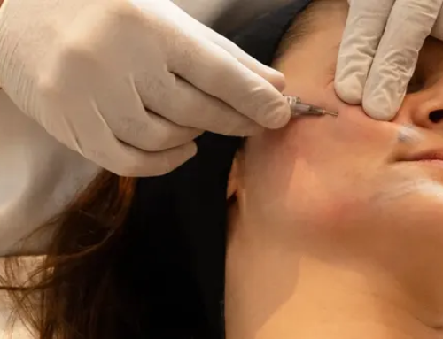 5 Signes indiquant qu’il est temps de réaliser vos injections de Botox